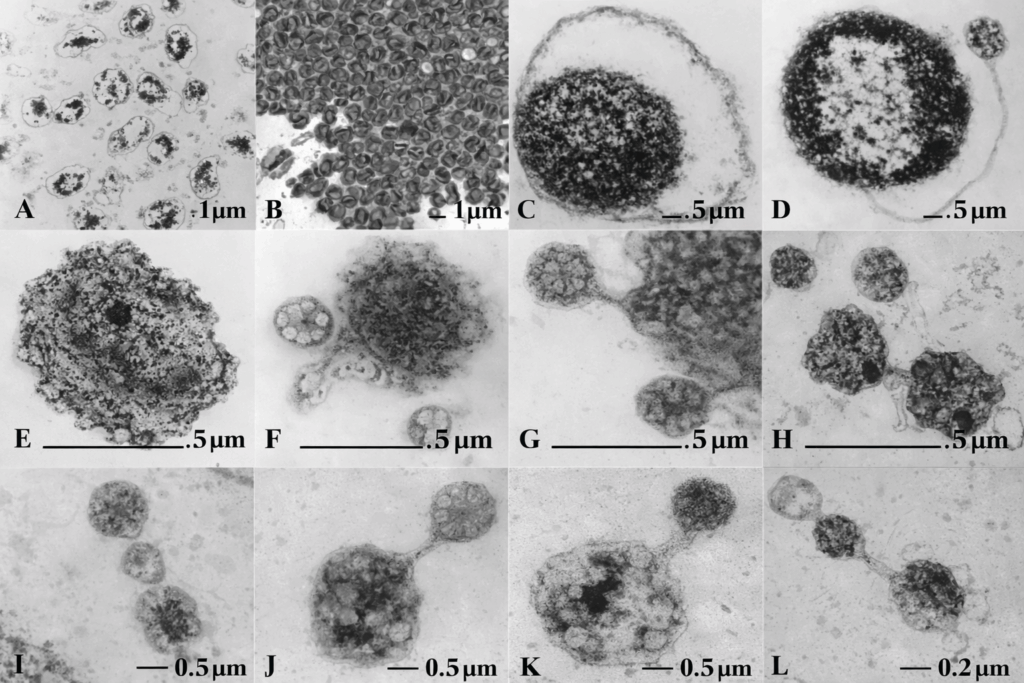 Grid of twelve labeled grayscale electron micrographs (A–L) displaying cellular and subcellular structures at varying magnifications with scale bars from 0.2 µm to 5 µm, showing diverse morphology including spherical bodies, clustered particles, and budding-like formations.