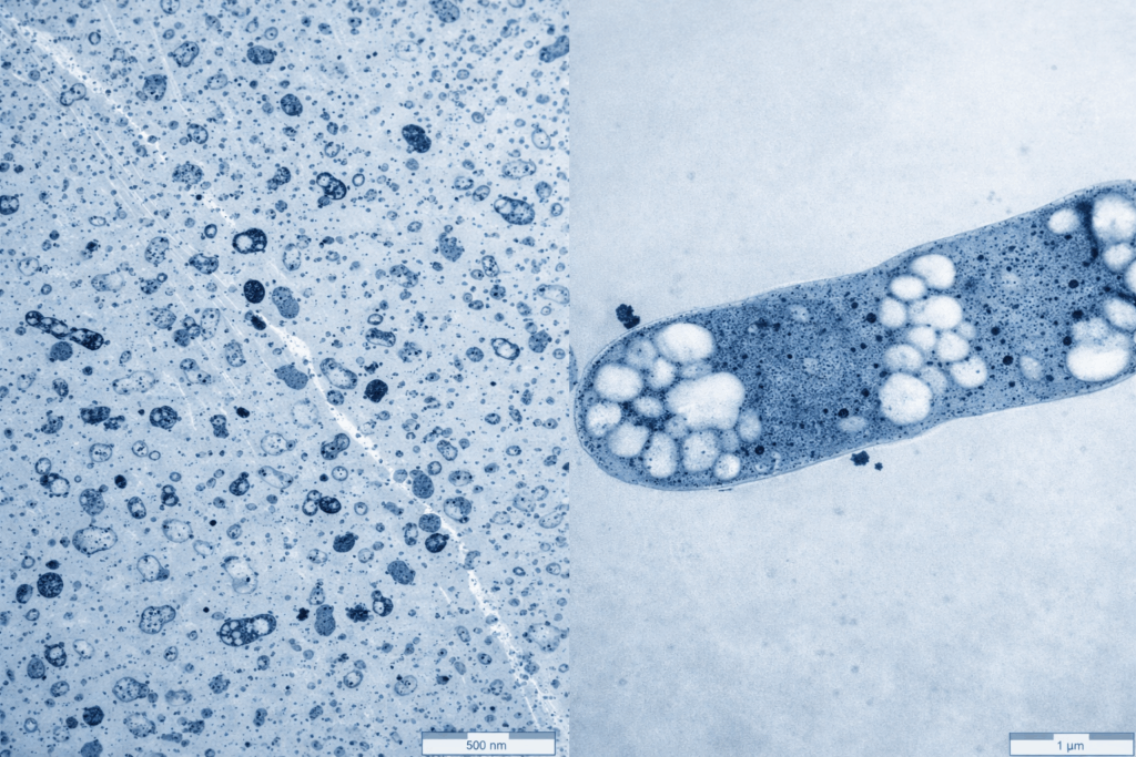 Blue-tinted electron microscope image showing numerous small cellular structures on the left and a rod-shaped bacterium on the right with visible internal inclusions; includes scale bars indicating nanometer and micrometer ranges.